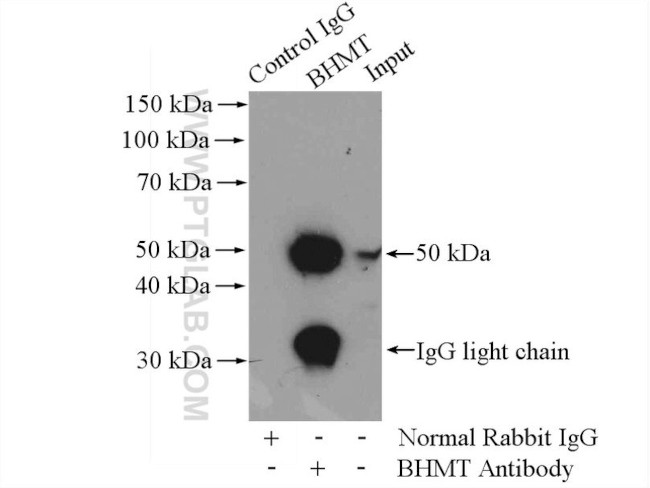 BHMT Antibody in Immunoprecipitation (IP)