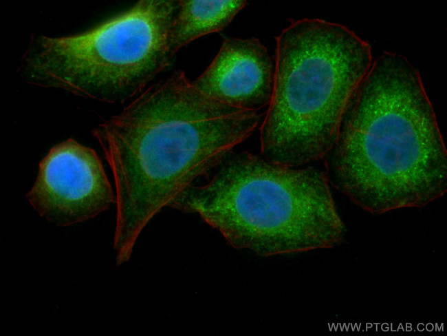 ERp57/ERp60 Antibody in Immunocytochemistry (ICC/IF)