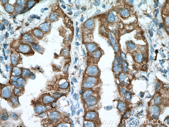 ERp57/ERp60 Antibody in Immunohistochemistry (Paraffin) (IHC (P))