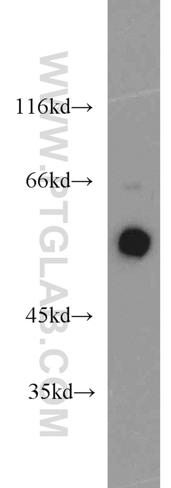 ERp57/ERp60 Antibody in Western Blot (WB)