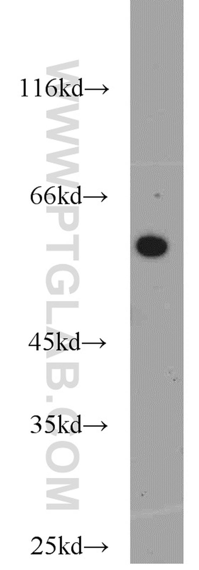 ERp57/ERp60 Antibody in Western Blot (WB)