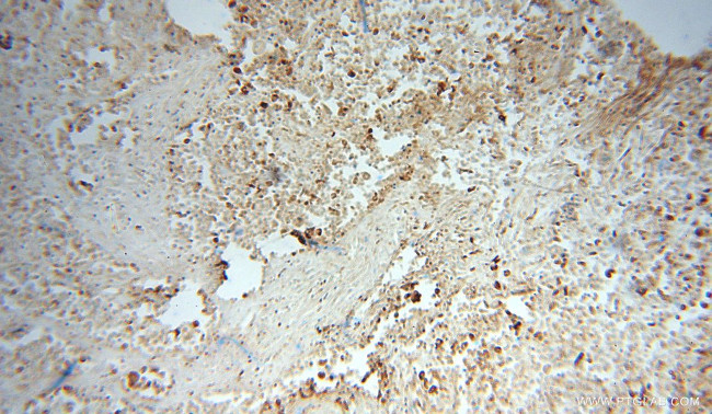 ERp57/ERp60 Antibody in Immunohistochemistry (Paraffin) (IHC (P))