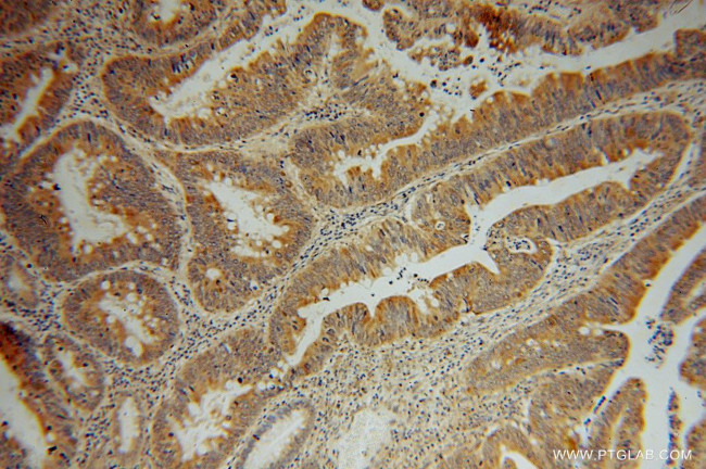 SDCCAG3 Antibody in Immunohistochemistry (Paraffin) (IHC (P))