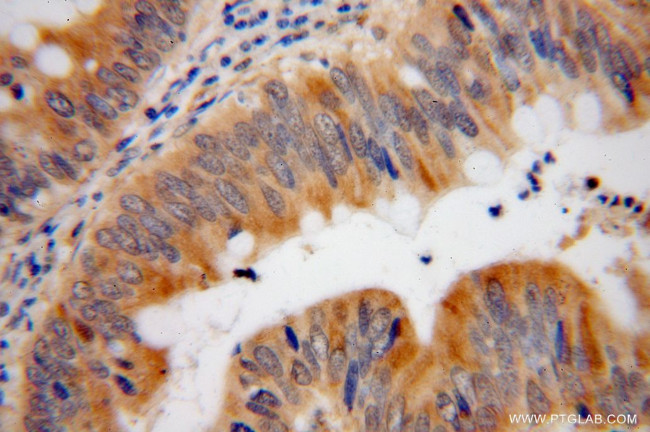 SDCCAG3 Antibody in Immunohistochemistry (Paraffin) (IHC (P))