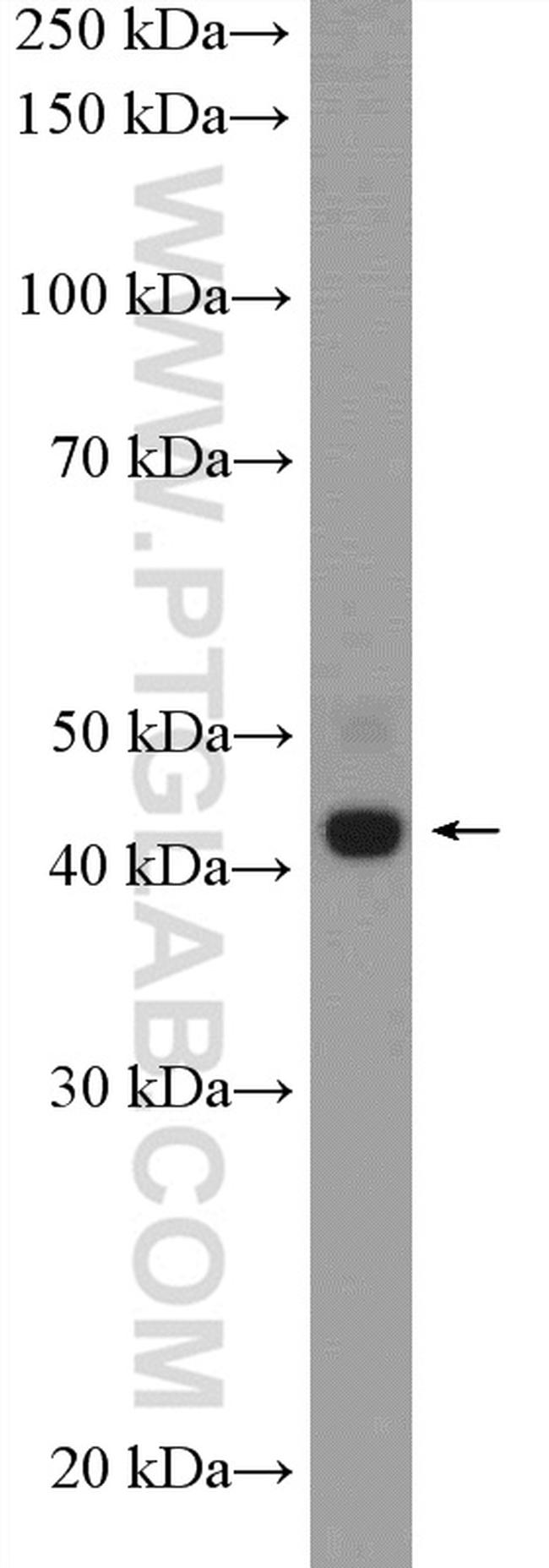 SDCCAG3 Antibody in Western Blot (WB)