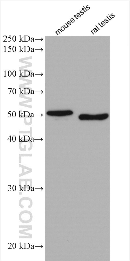 SDCCAG3 Antibody in Western Blot (WB)