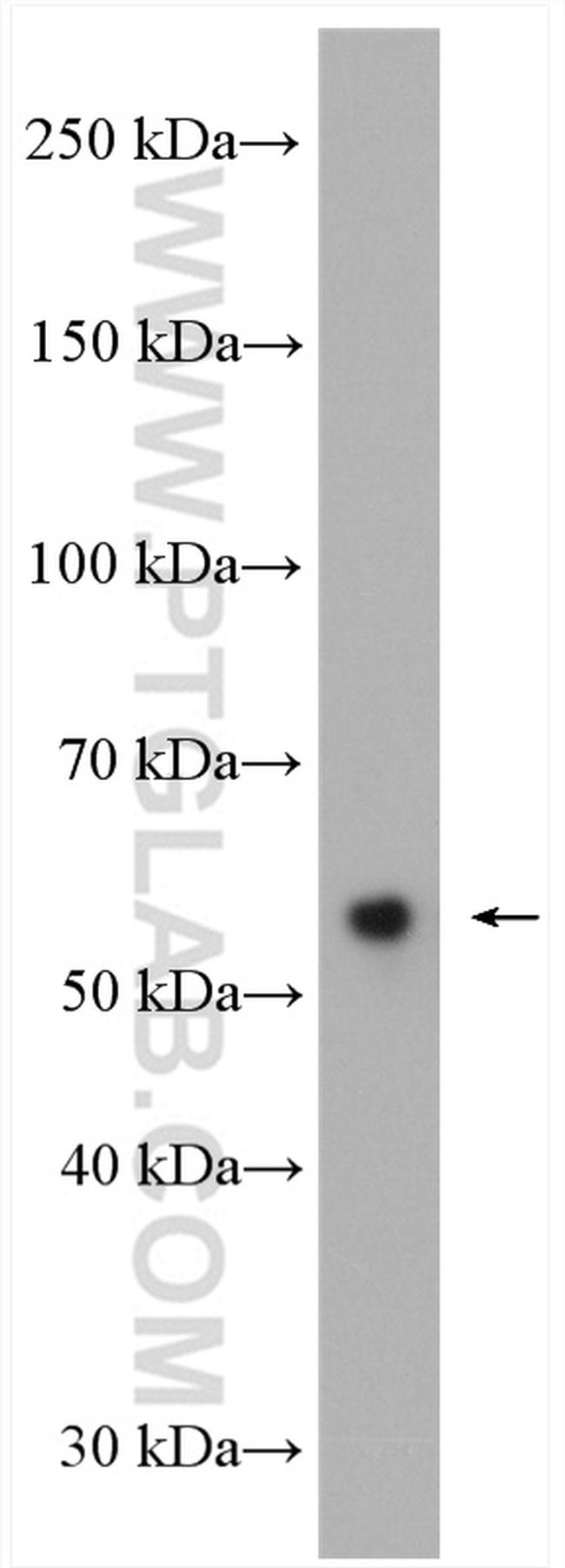 SDCCAG3 Antibody in Western Blot (WB)