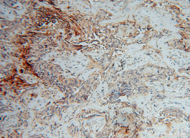 IMMP2L Antibody in Immunohistochemistry (Paraffin) (IHC (P))