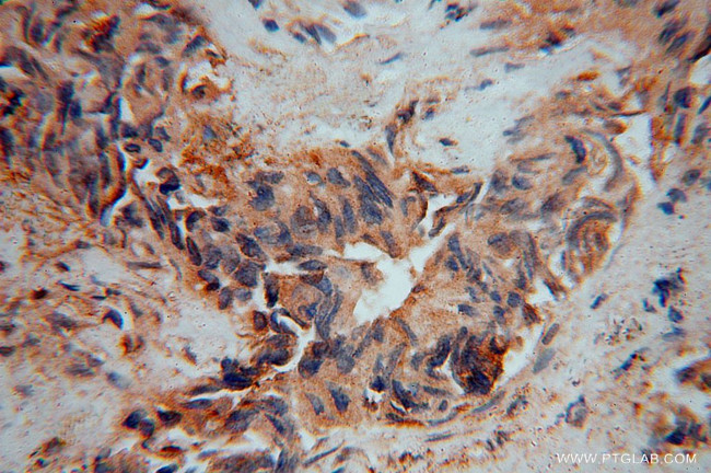 IMMP2L Antibody in Immunohistochemistry (Paraffin) (IHC (P))