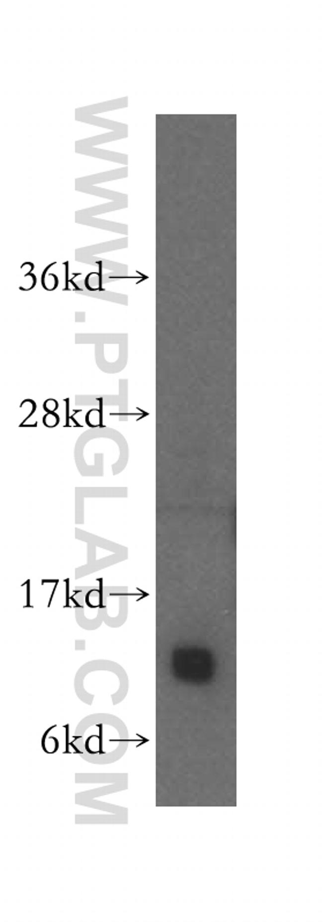 IMMP2L Antibody in Western Blot (WB)