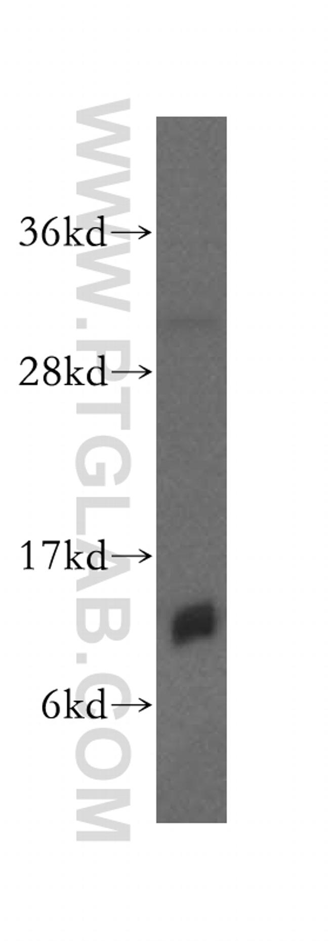 IMMP2L Antibody in Western Blot (WB)