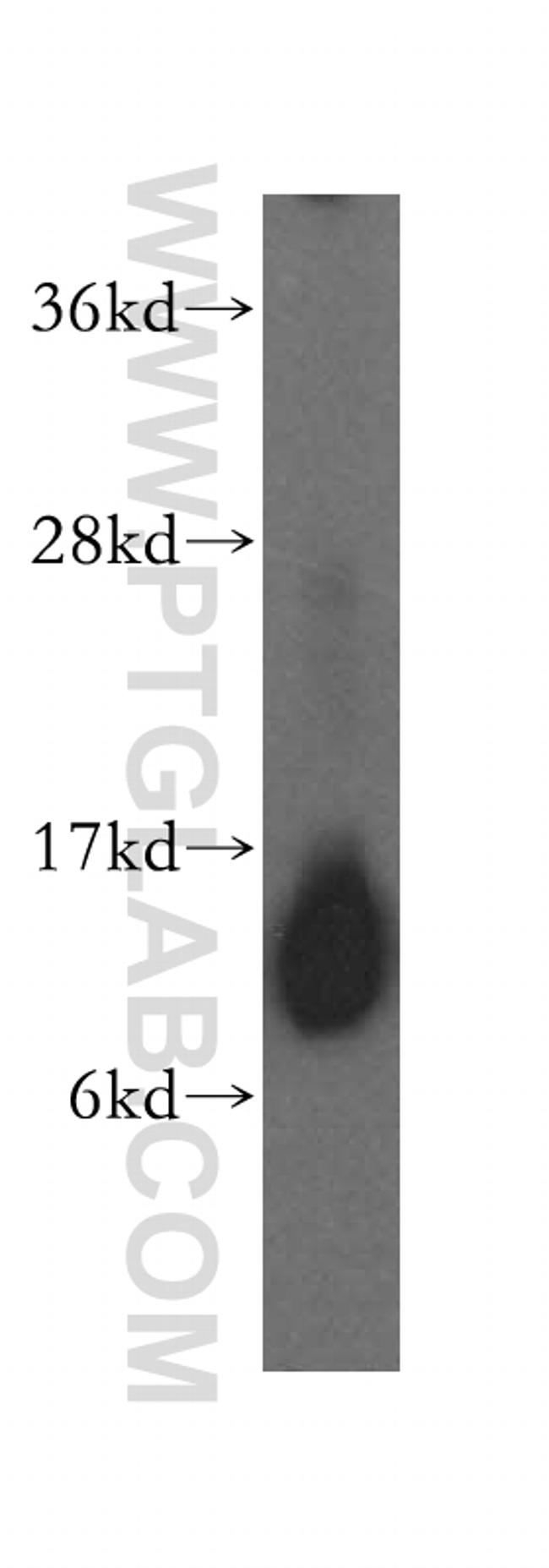 IMMP2L Antibody in Western Blot (WB)