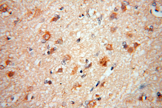 ACOT7 Antibody in Immunohistochemistry (Paraffin) (IHC (P))