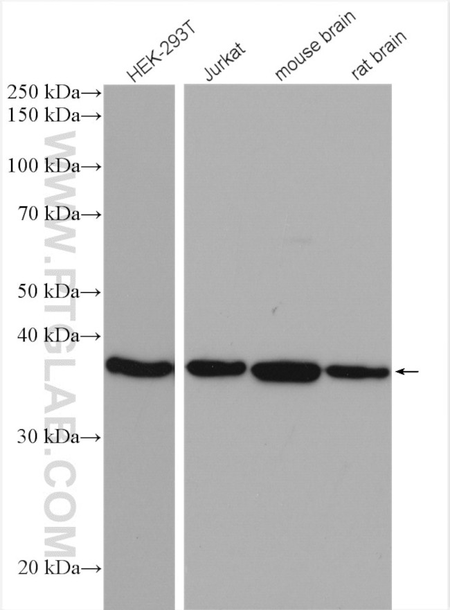 ACOT7 Antibody in Western Blot (WB)