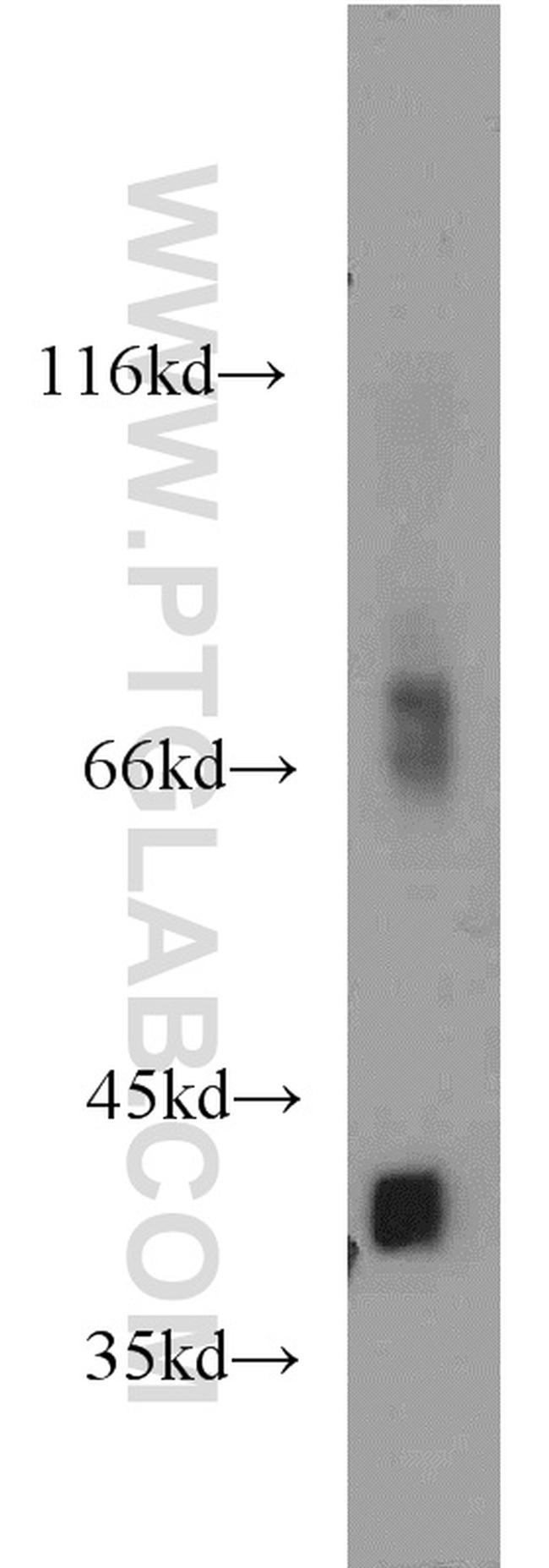 ACOT7 Antibody in Western Blot (WB)