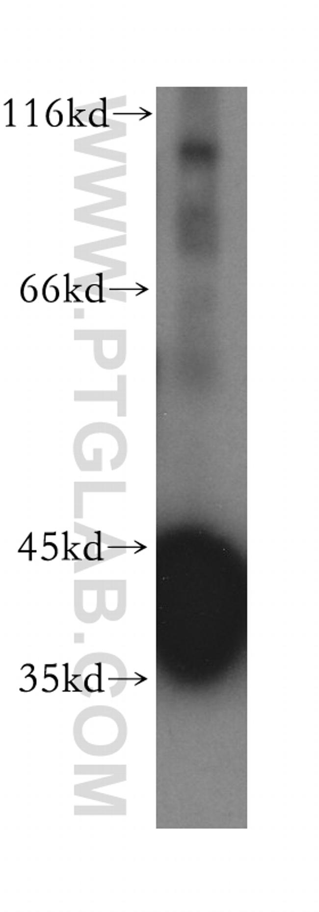 ACOT7 Antibody in Western Blot (WB)