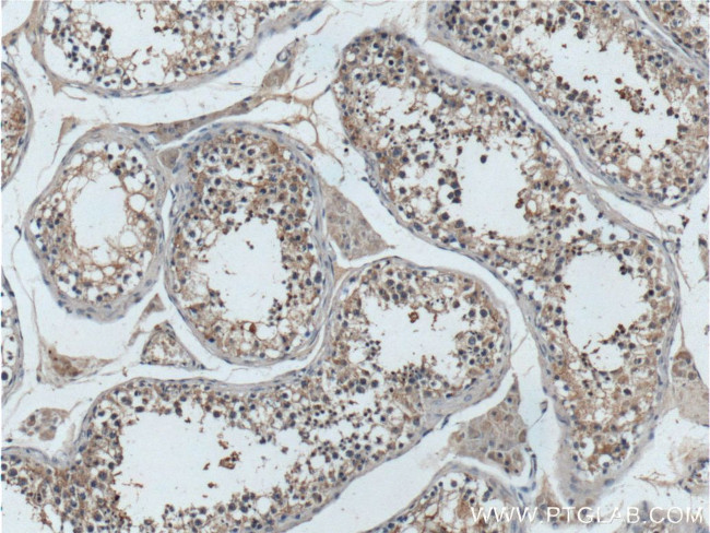 TELO2 Antibody in Immunohistochemistry (Paraffin) (IHC (P))