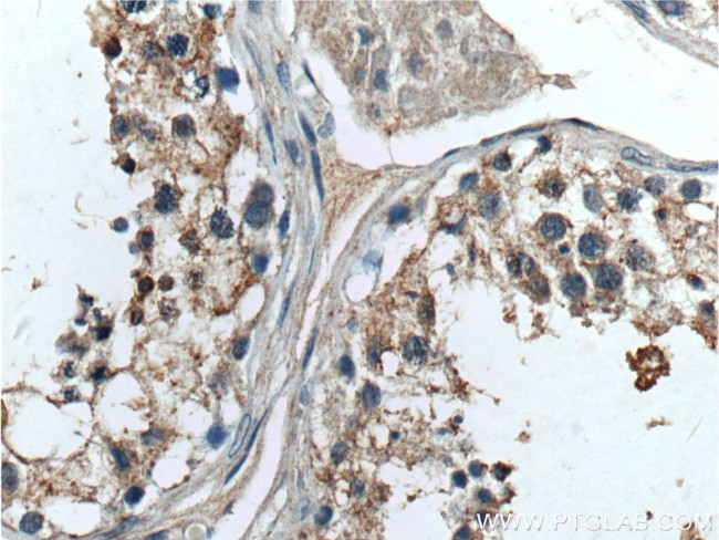 TELO2 Antibody in Immunohistochemistry (Paraffin) (IHC (P))