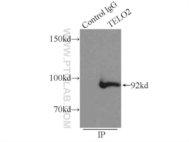 TELO2 Antibody in Immunoprecipitation (IP)