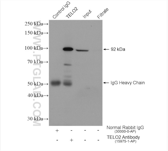 TELO2 Antibody in Immunoprecipitation (IP)