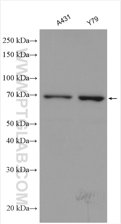 TELO2 Antibody in Western Blot (WB)