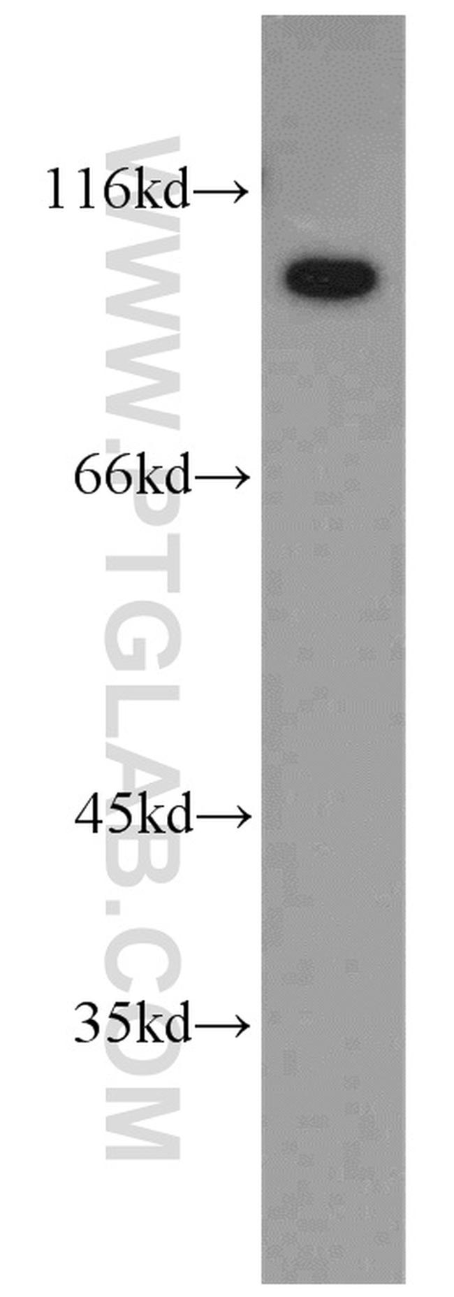 TELO2 Antibody in Western Blot (WB)