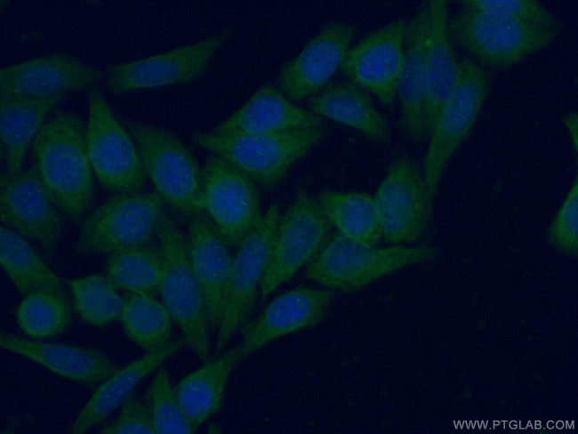 ISG15 Antibody in Immunocytochemistry (ICC/IF)