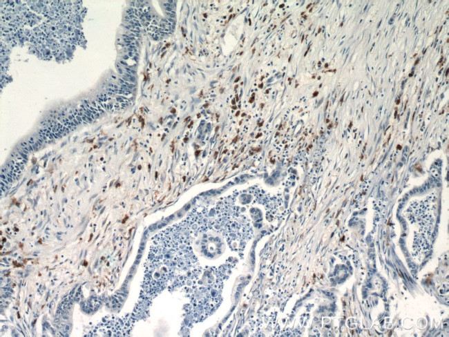 ISG15 Antibody in Immunohistochemistry (Paraffin) (IHC (P))