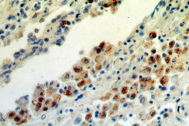 ISG15 Antibody in Immunohistochemistry (Paraffin) (IHC (P))