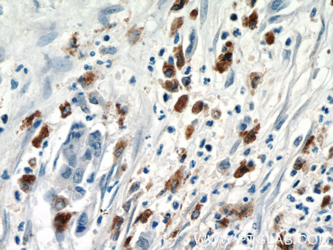 ISG15 Antibody in Immunohistochemistry (Paraffin) (IHC (P))