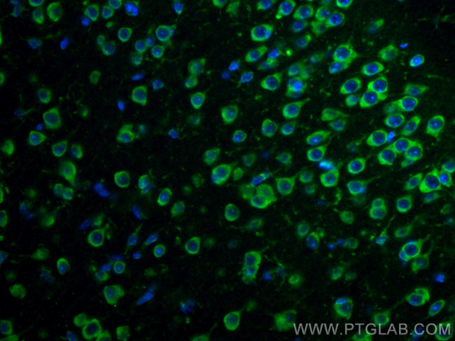 ISG15 Antibody in Immunohistochemistry (PFA fixed) (IHC (PFA))