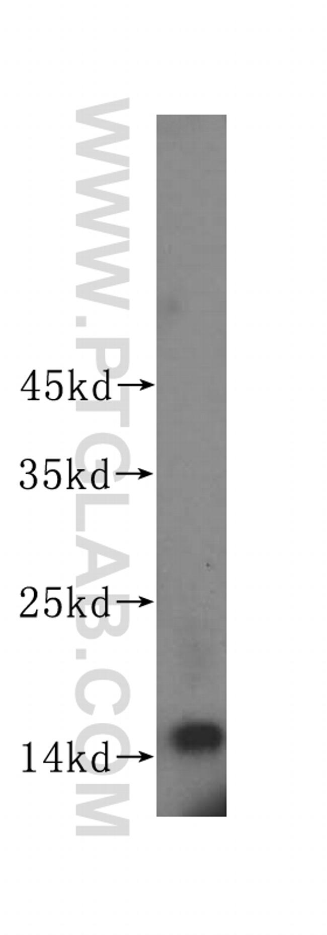 ISG15 Antibody in Western Blot (WB)