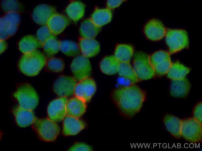 PSMB3 Antibody in Immunocytochemistry (ICC/IF)