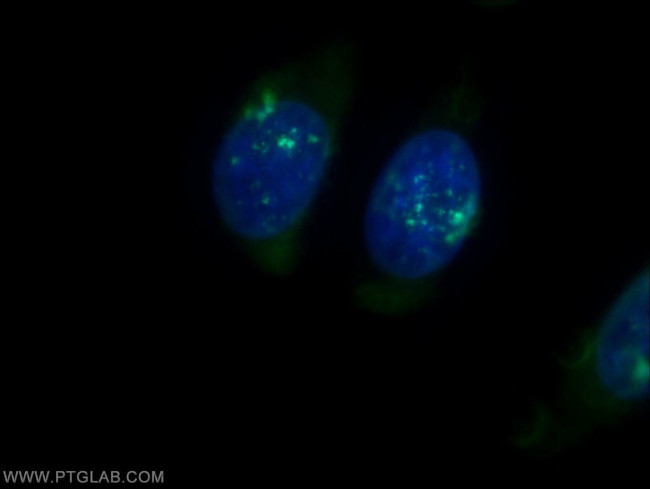 PSMB3 Antibody in Immunocytochemistry (ICC/IF)