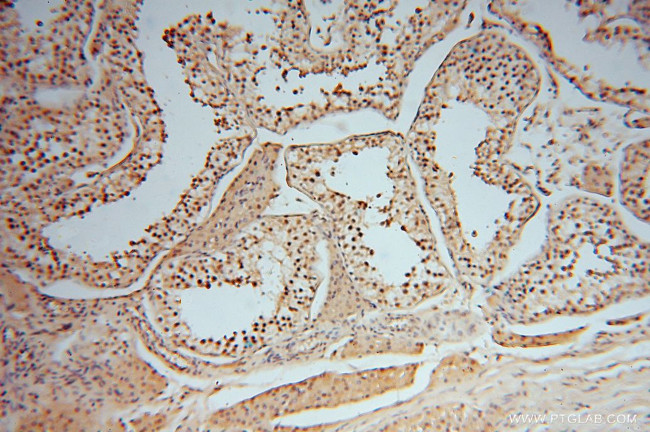 PSMB3 Antibody in Immunohistochemistry (Paraffin) (IHC (P))