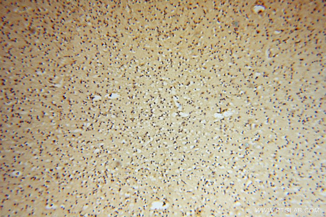 PSMB3 Antibody in Immunohistochemistry (Paraffin) (IHC (P))