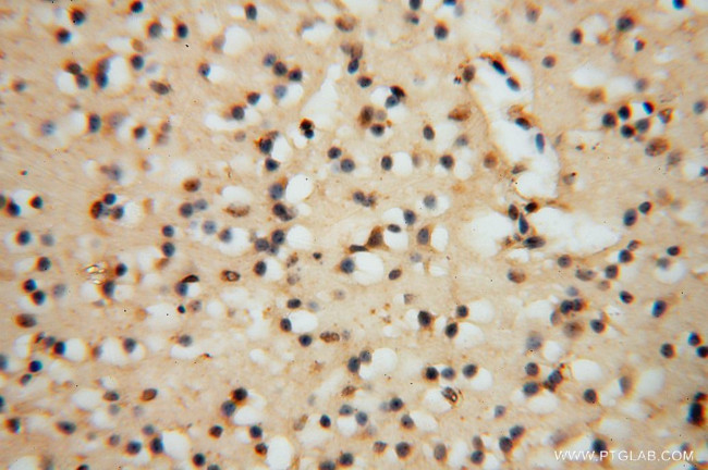 PSMB3 Antibody in Immunohistochemistry (Paraffin) (IHC (P))