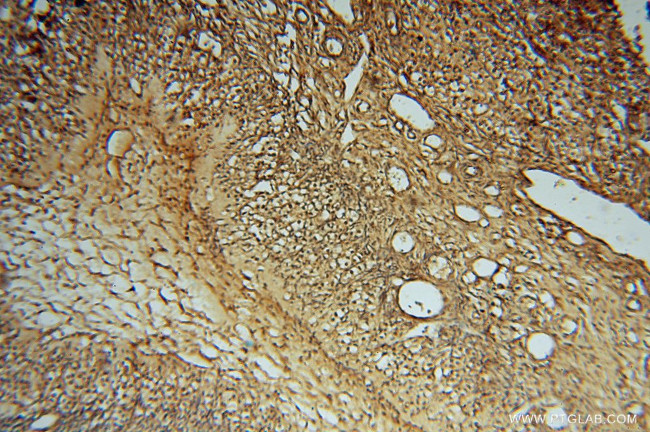 PSMB3 Antibody in Immunohistochemistry (Paraffin) (IHC (P))