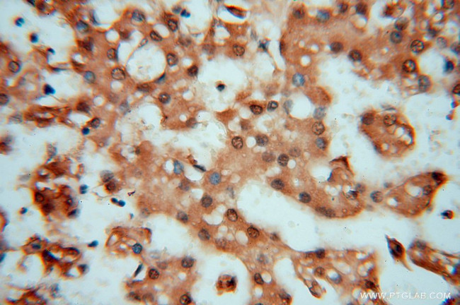 PSMB3 Antibody in Immunohistochemistry (Paraffin) (IHC (P))