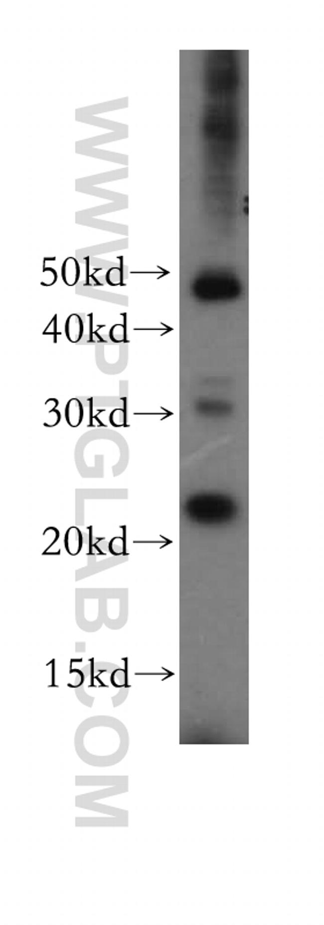 PSMB3 Antibody in Western Blot (WB)