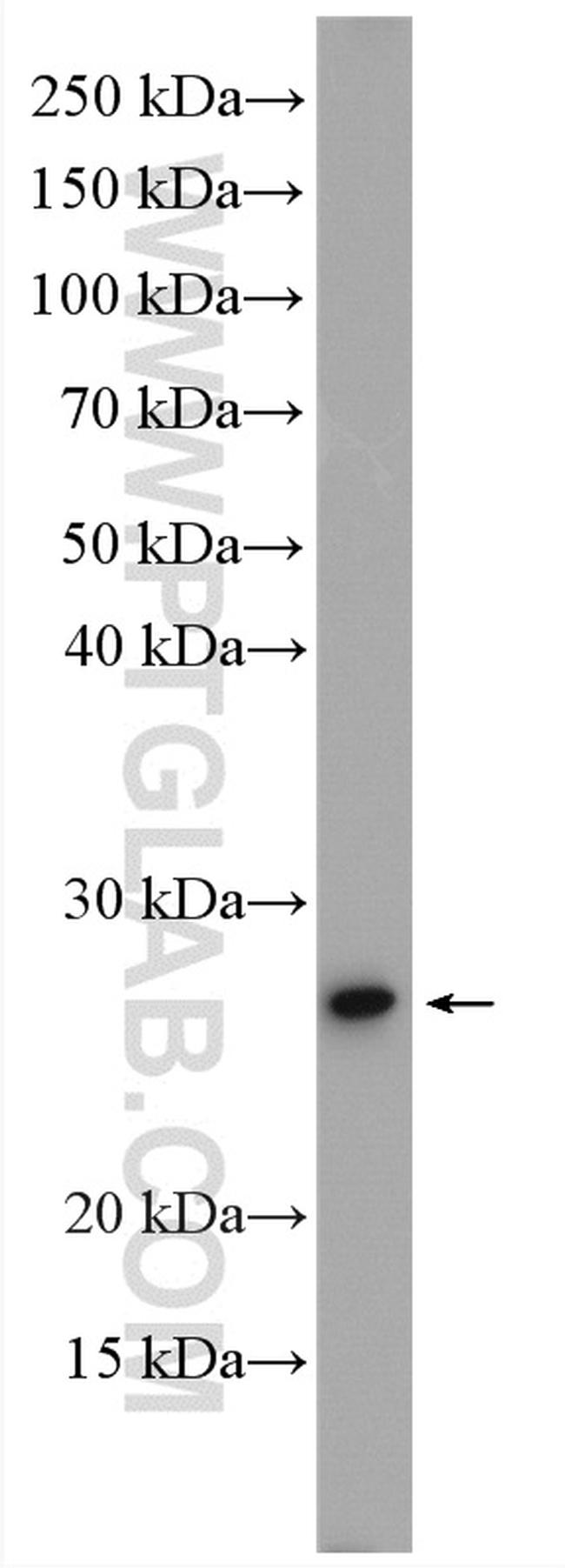 PSMB3 Antibody in Western Blot (WB)