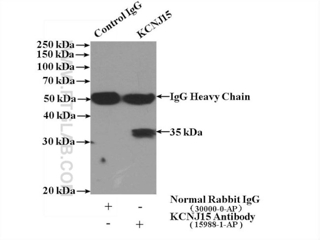 KCNJ15 Antibody in Immunoprecipitation (IP)