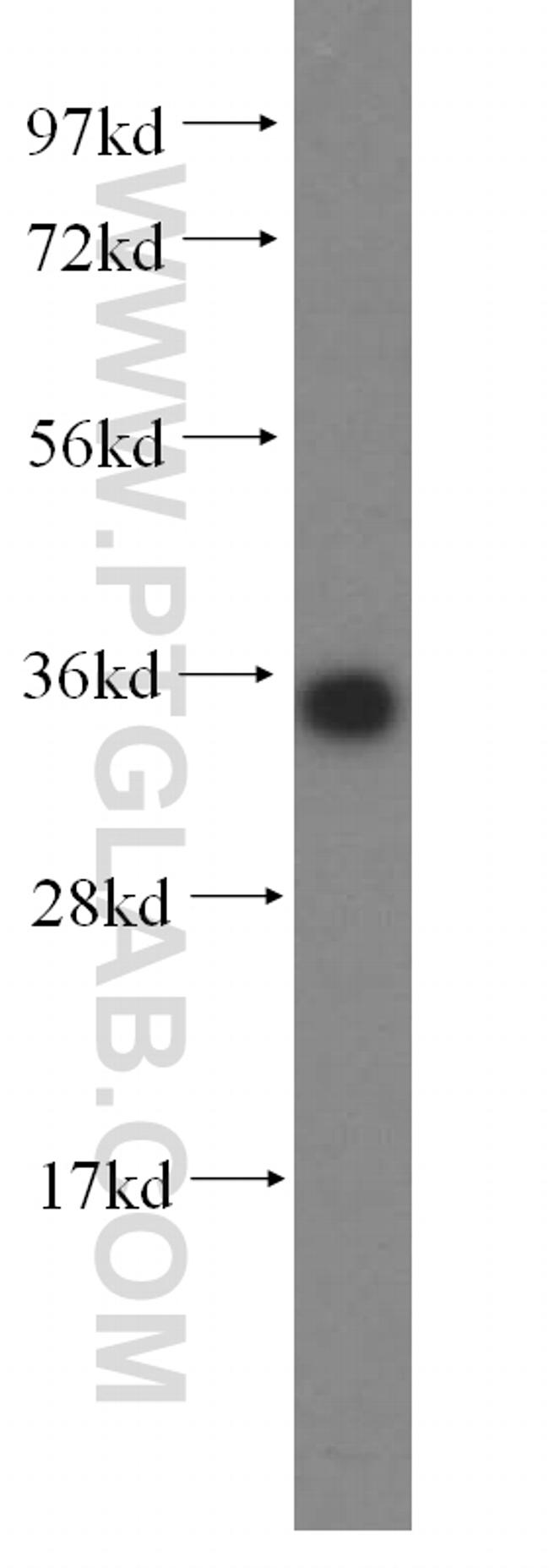 KCNJ15 Antibody in Western Blot (WB)