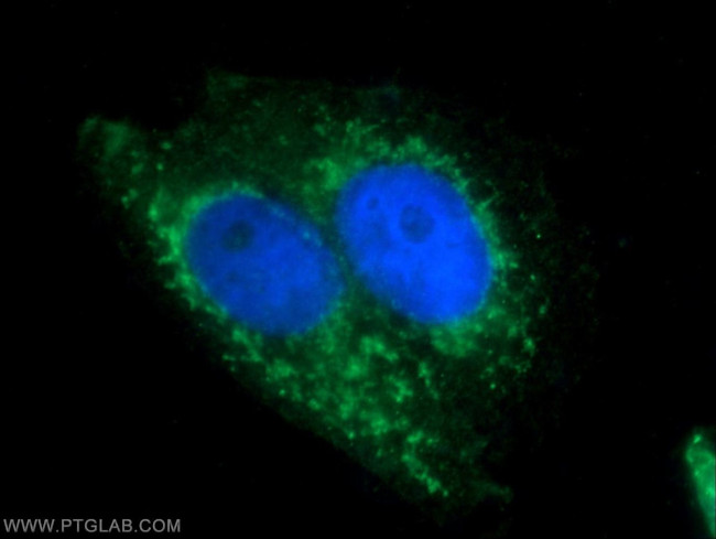 BAAT Antibody in Immunocytochemistry (ICC/IF)