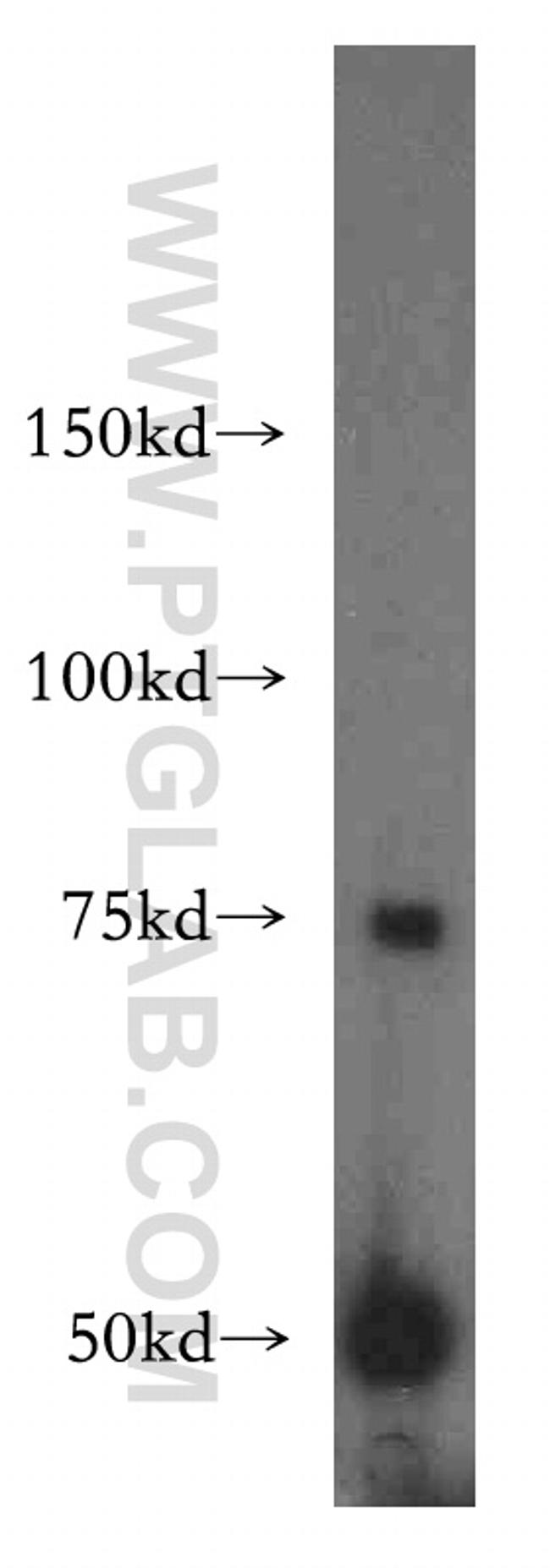 BAAT Antibody in Western Blot (WB)