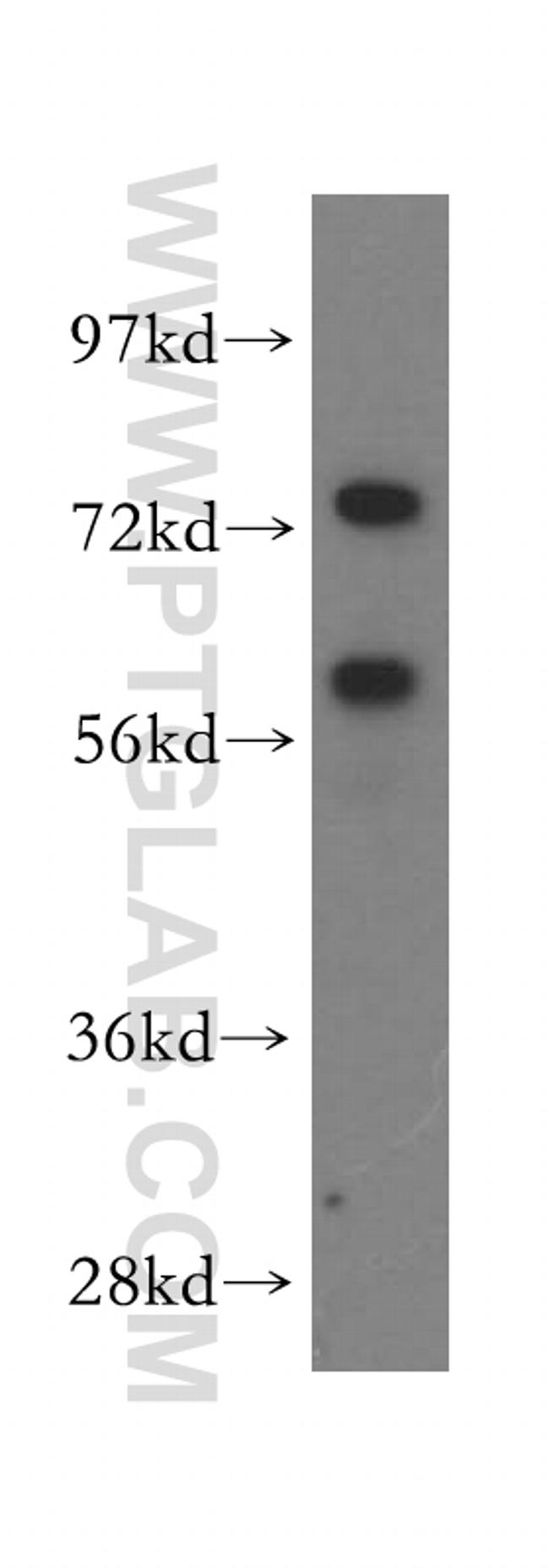 CCT7 Antibody in Western Blot (WB)