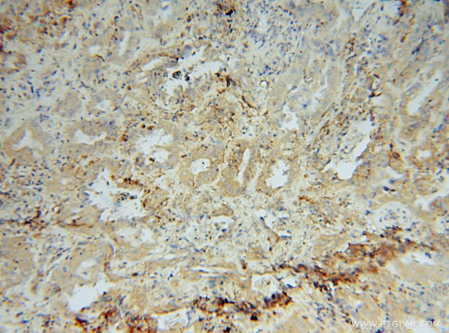 PRCP Antibody in Immunohistochemistry (Paraffin) (IHC (P))