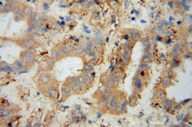 PRCP Antibody in Immunohistochemistry (Paraffin) (IHC (P))