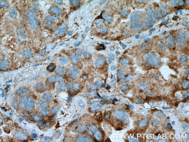 PRCP Antibody in Immunohistochemistry (Paraffin) (IHC (P))