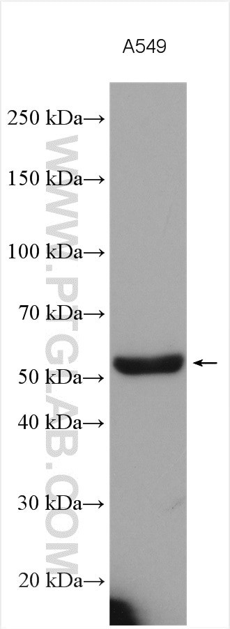 PRCP Antibody in Western Blot (WB)